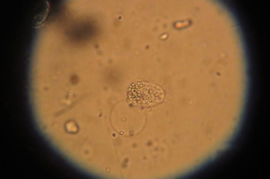 Amoeba ID